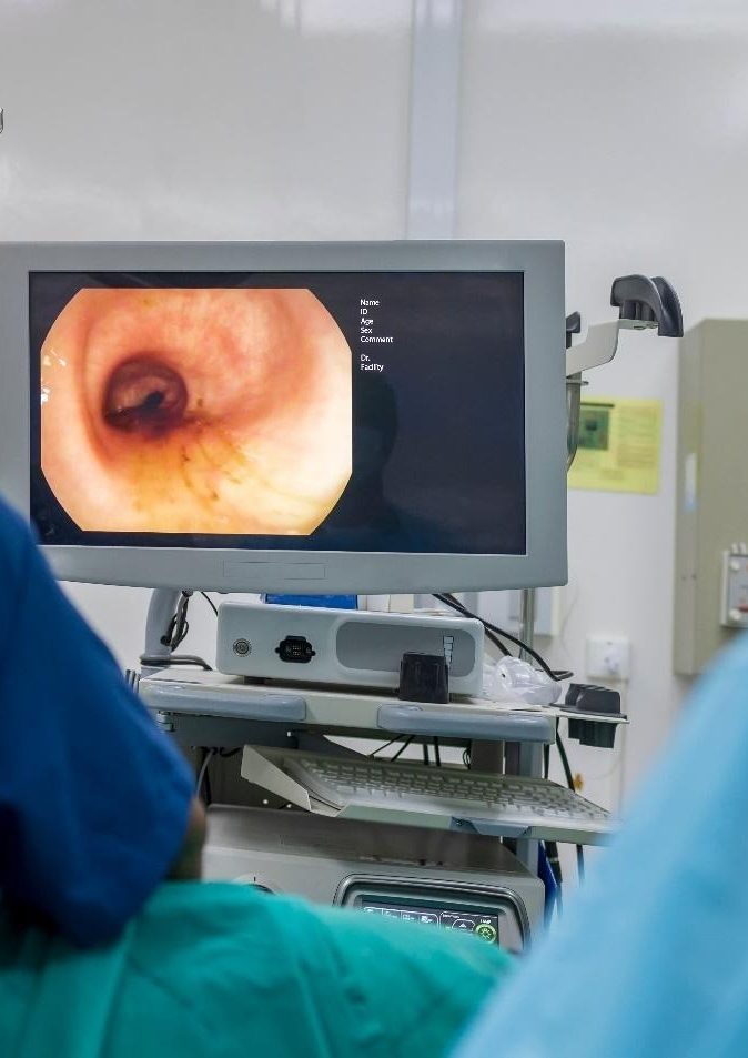 how colorectal cancer is staged.