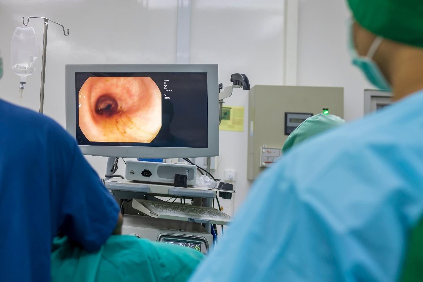 how colorectal cancer is staged.